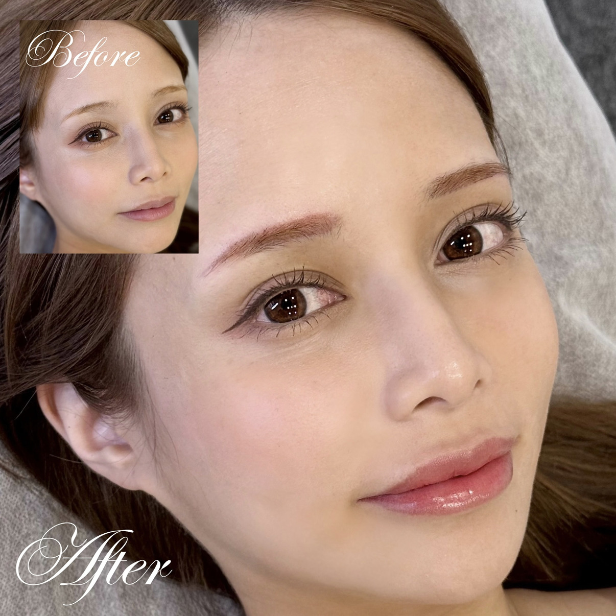 医療アートメイク症例写真　眉　マシン毛並み　東京・恵比寿のアートメイクラボ