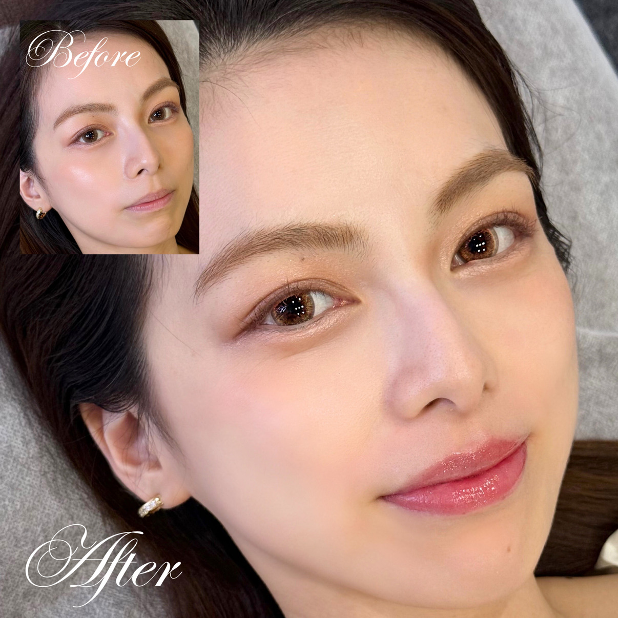 医療アートメイク症例写真　眉　マシン毛並み　東京・恵比寿のアートメイクラボ