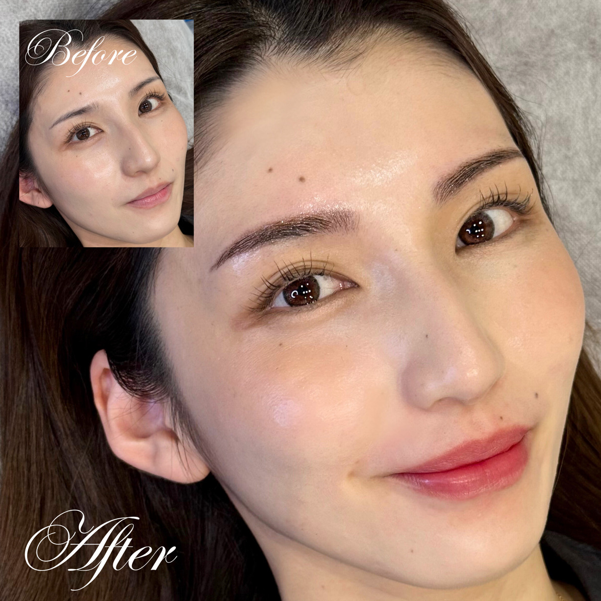 医療アートメイク症例写真　リップ　東京・恵比寿のアートメイクラボ