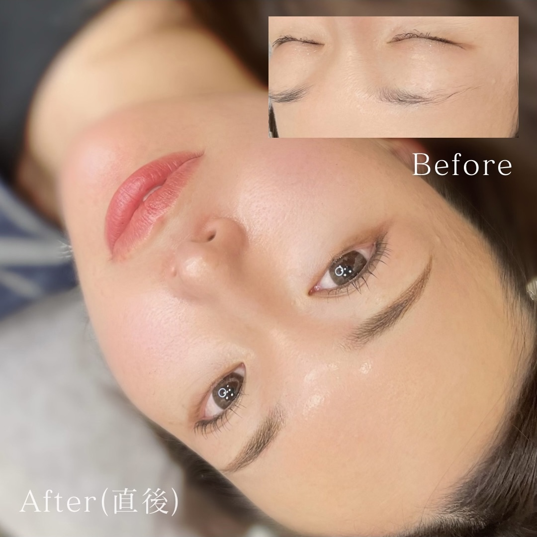 医療アートメイク症例写真　眉　毛並み+パウダー技法　平行アーチ眉　東京・恵比寿のアートメイクラボ