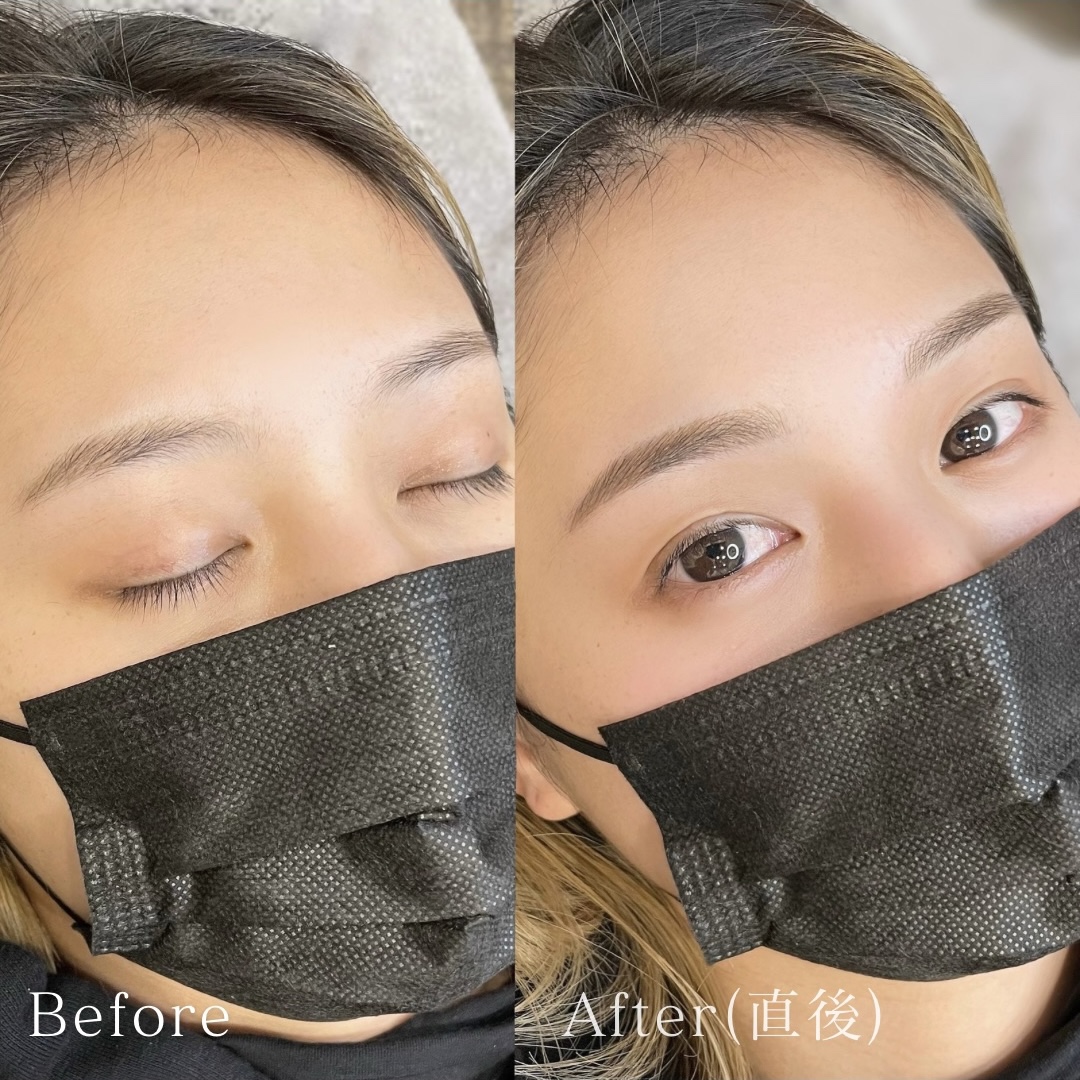 医療アートメイク症例写真　眉　毛並み+パウダー技法　平行アーチ眉　東京・恵比寿のアートメイクラボ